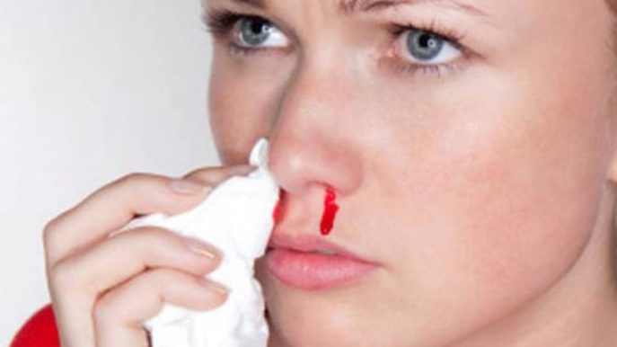 Как остановить кровь из носа у взрослого в домашних условиях и тошнит