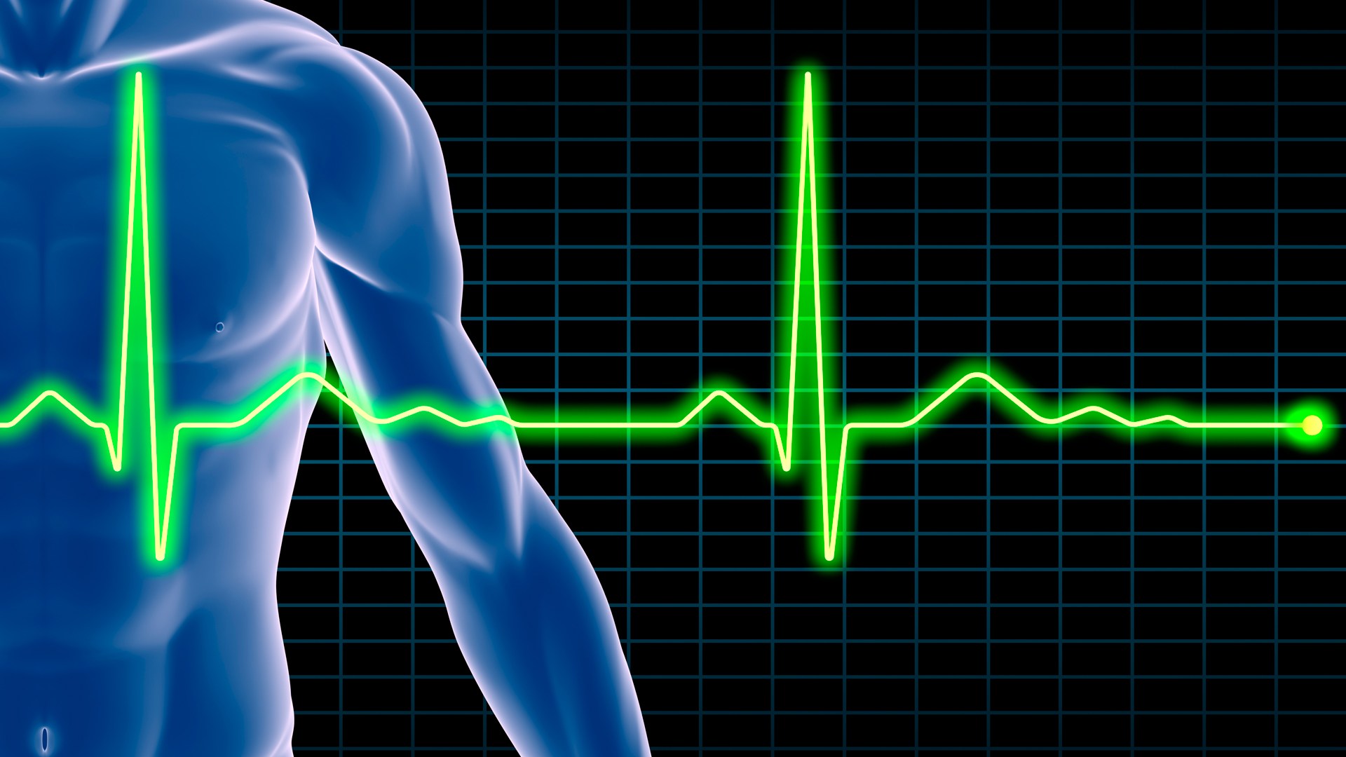 Экг. ЭКГ сердца. Медицина кардиограмма. Кардиограмма сердца человека. Кардиограмма фото.