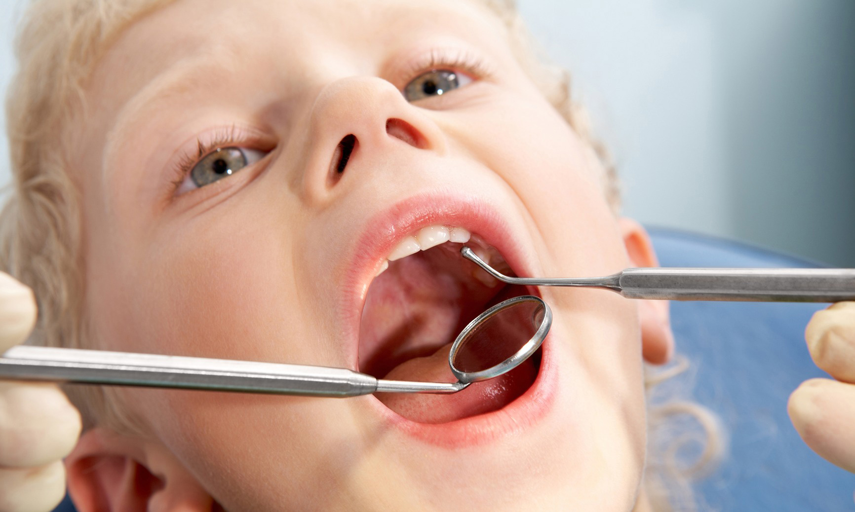 Стоматит у детей в полости рта